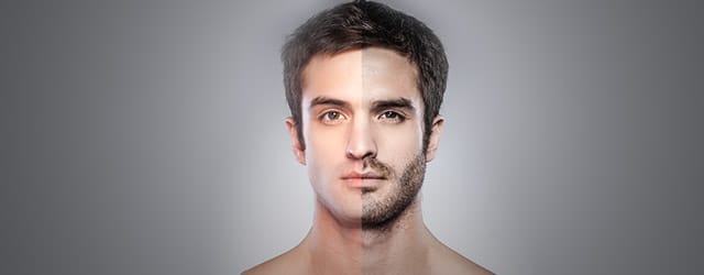 Foliculite: Aprenda os segredos para fazer a sua barba crescer rapidamente 2 Foliculite: Aprenda os segredos para fazer a sua barba crescer rapidamente 1