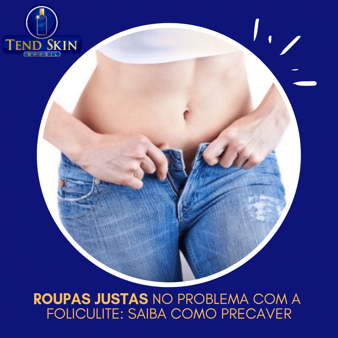 Foliculite: Roupas justas no problema com a foliculite: saiba como precaver 2 Foliculite: Roupas justas no problema com a foliculite: saiba como precaver 1