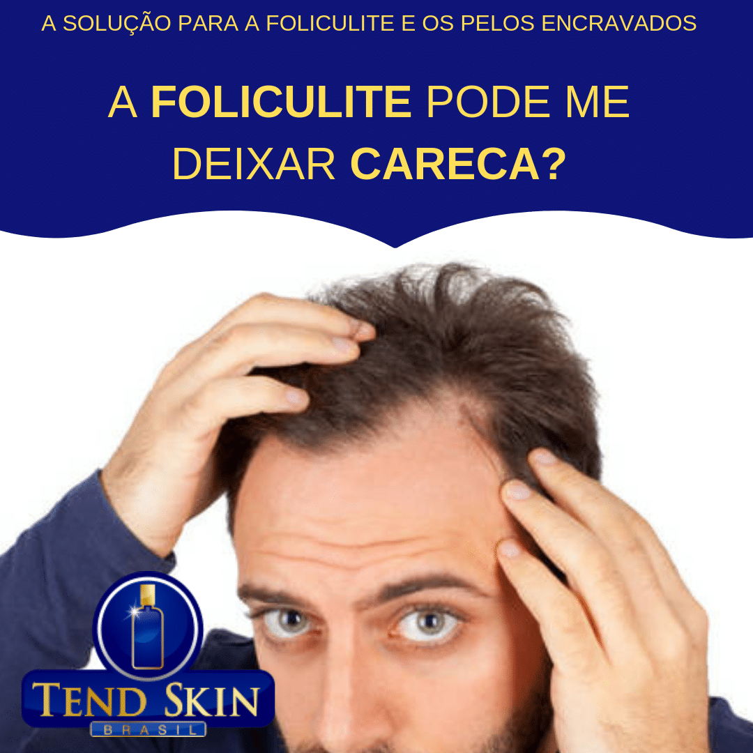 Foliculite: A foliculite pode me deixar careca? 2 Foliculite: A foliculite pode me deixar careca? 1