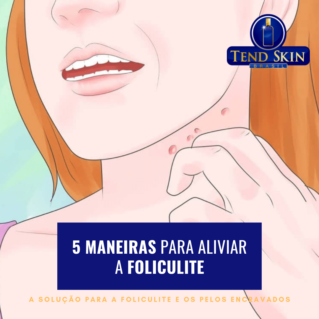 Foliculite: 5 maneiras para aliviar a foliculite 2 Foliculite: 5 maneiras para aliviar a foliculite 1
