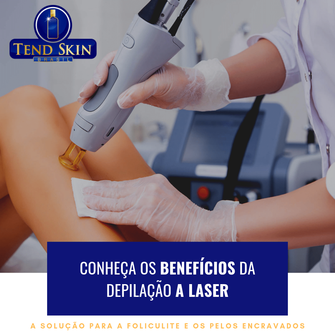 Foliculite: Conheça os benefícios da depilação a laser 2 Foliculite: Conheça os benefícios da depilação a laser 1