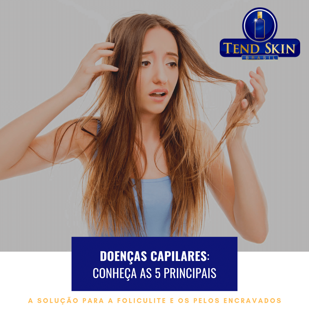 Foliculite: Doenças capilares: conheça as 5 principais 2 Foliculite: Doenças capilares: conheça as 5 principais 1