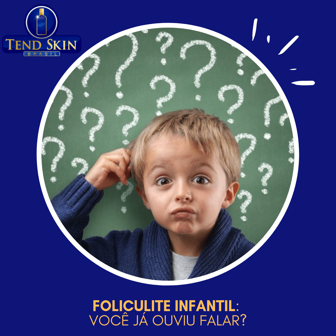 Foliculite: Foliculite infantil: você já ouviu falar? 2 Foliculite: Foliculite infantil: você já ouviu falar? 1