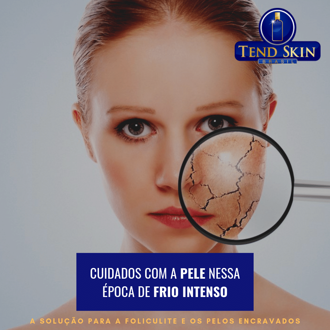 Foliculite: Cuidados com a pele nessa época de frio intenso 2 Foliculite: Cuidados com a pele nessa época de frio intenso 1