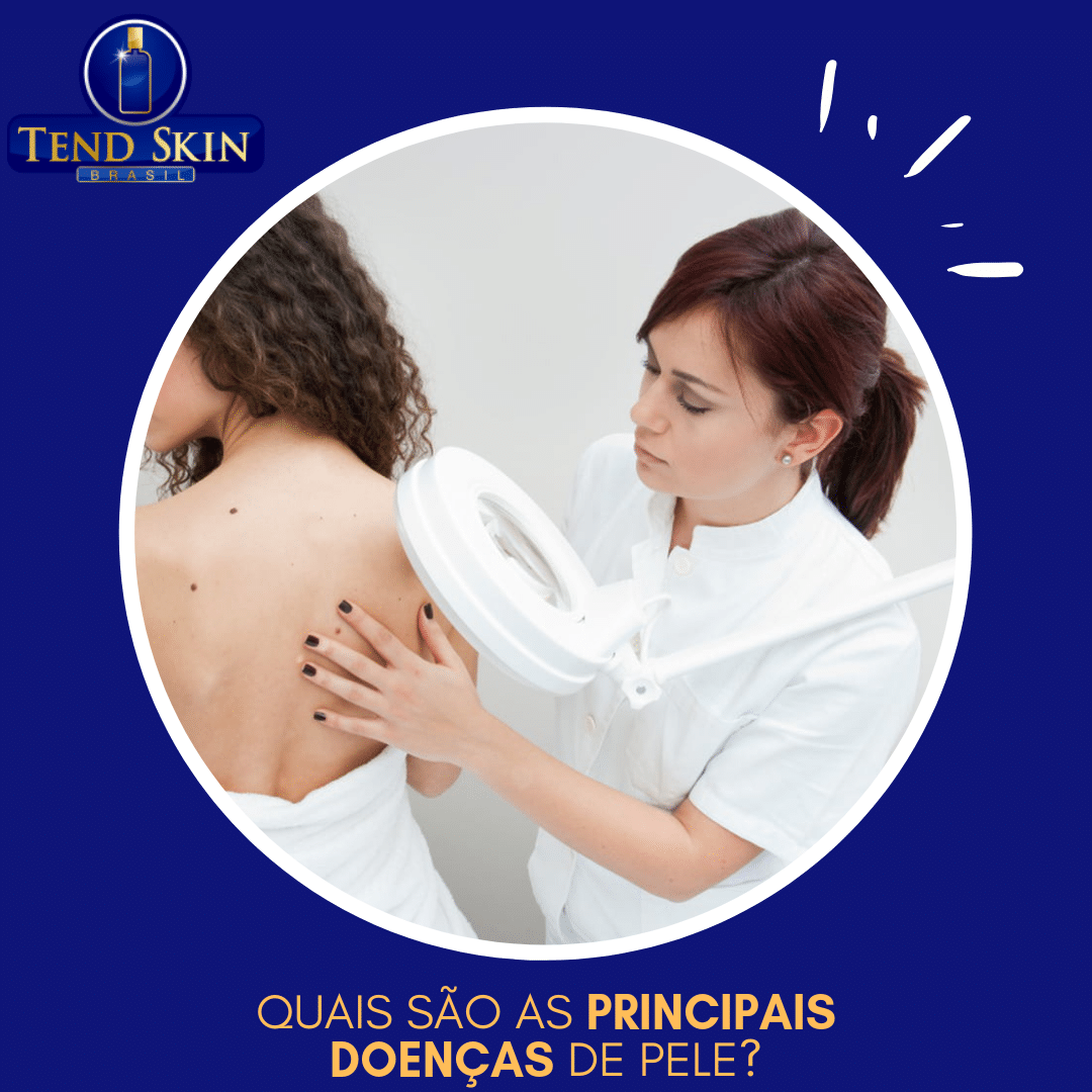 Foliculite: Quais são as principais doenças de pele? 2 Foliculite: Quais são as principais doenças de pele? 1