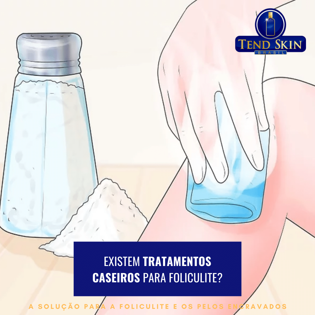 Foliculite: Existem tratamentos caseiros para foliculite? 2 Foliculite: Existem tratamentos caseiros para foliculite? 1