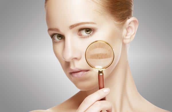 Foliculite: Você sabe o que é Hipercromia? 1 Foto de Hipercromia