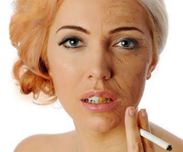 Foliculite: Cigarro pode causar foliculite e outros problemas para pele e cabelo 2 Foliculite: Cigarro pode causar foliculite e outros problemas para pele e cabelo 1