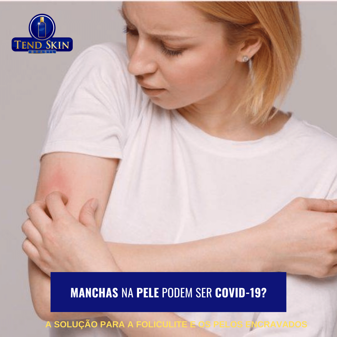 Foliculite: Manchas na pele podem ser Covid-19? 2 Foliculite: Manchas na pele podem ser Covid-19? 1